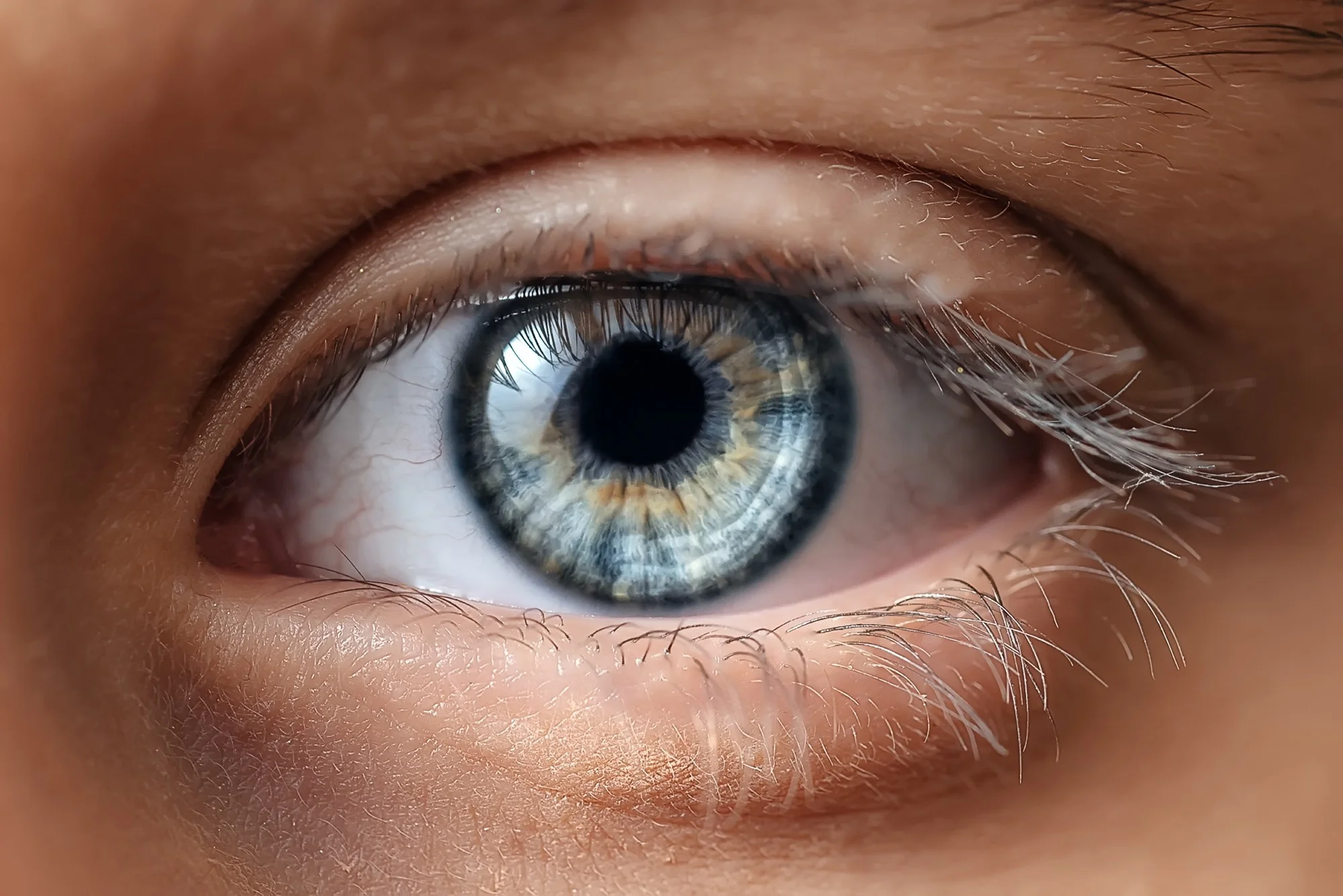 olho humano _ anatomia do globo ocular