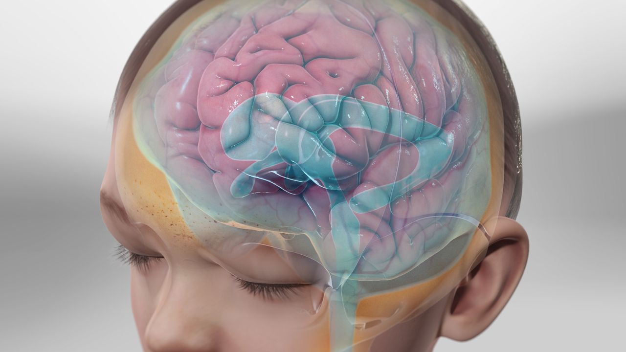 Descubra tudo sobre hidrocefalia: sinais, diagnóstico e tratamentos. Mantenha-se informado com a AzonoMED!